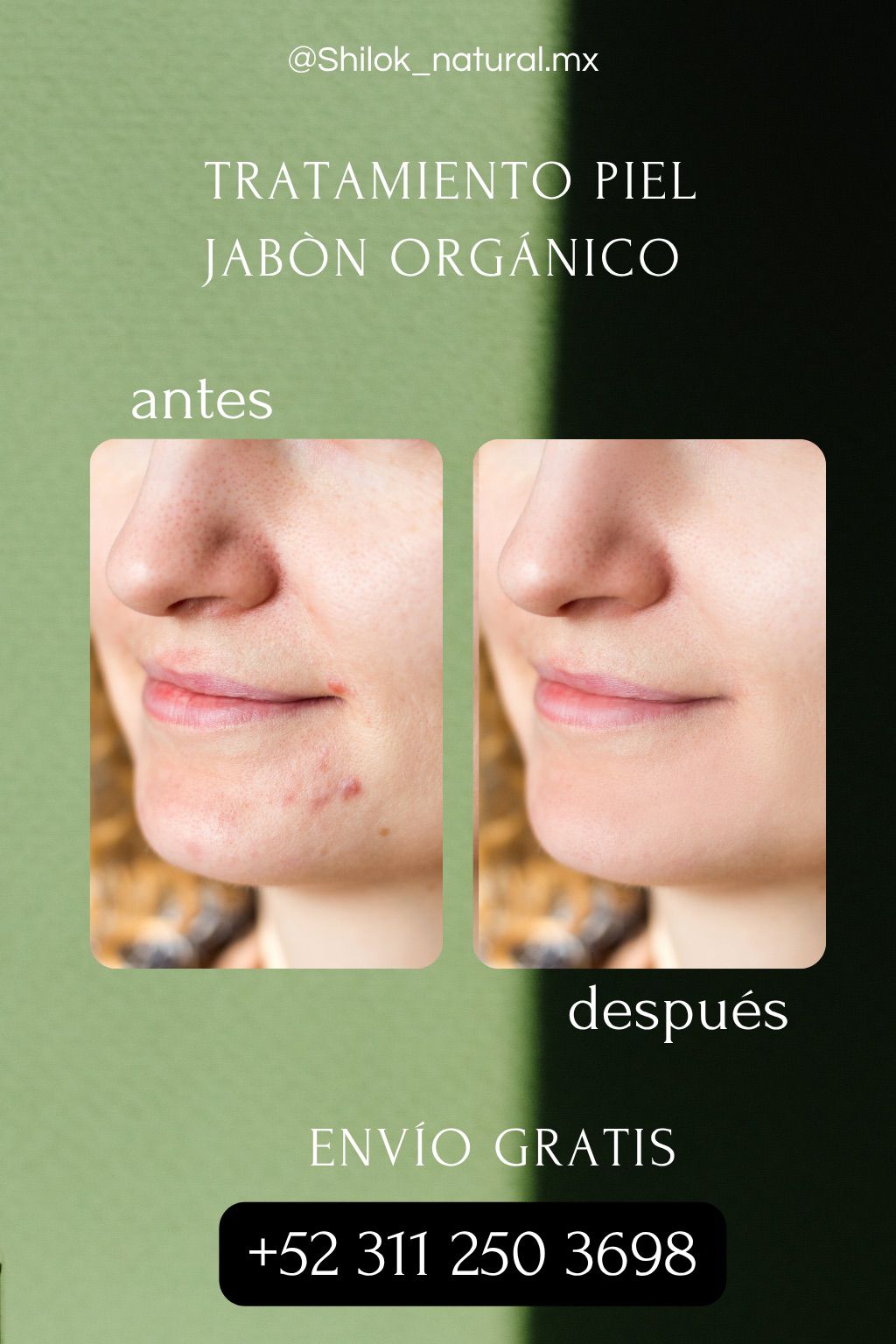 Pack de 3 Jabones Shilok – ¡Tu piel como nunca antes! ENVIO GRATIS